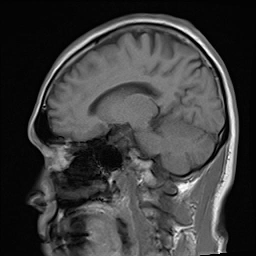 Click on the Serie image to view the images of VILLANUEVA, WILLIAM A.